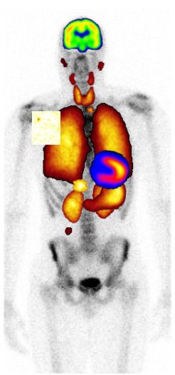 Nukle&aelig;rmedisin